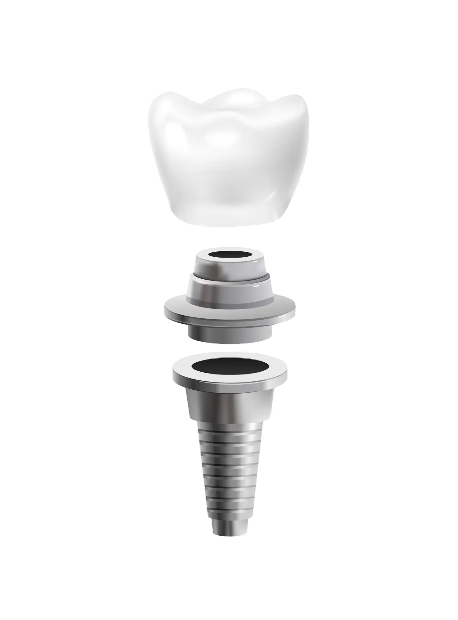 Implantology Products