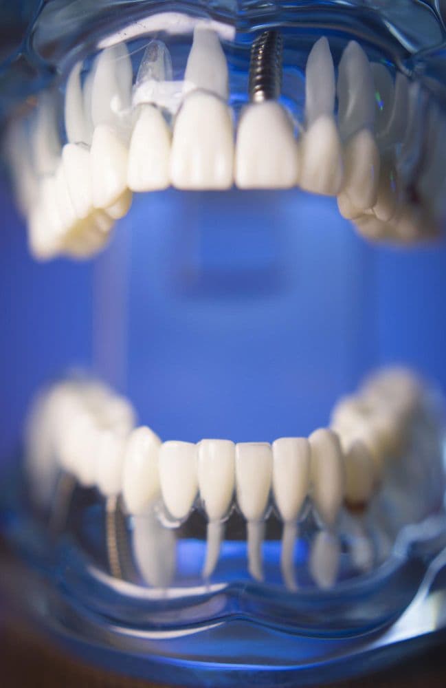 Teeth