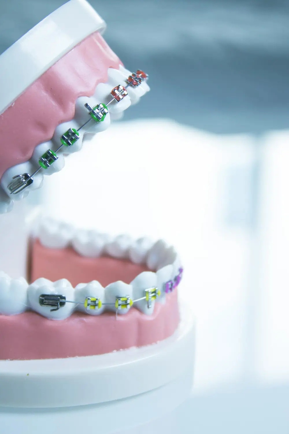 Orthodontic Equipment